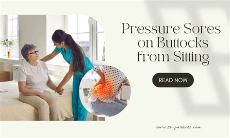 funny buttocks images|pressure sores on buttocks pictures.